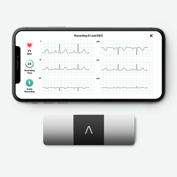 AliveCor KardiaMobile 6L personal ECG device, shown with a smartphone displaying a six-lead ECG trace