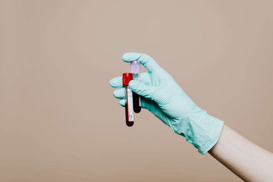 blood test sample